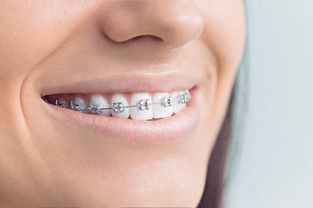 Best Full Mouth Reconstruction  in Marlboro Village, MD